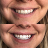 cozy smile kit